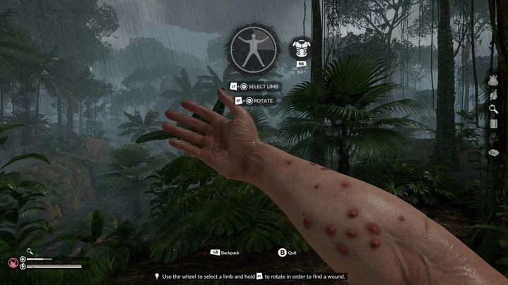 遊戲中獨特的身體檢查系統,玩家需要仔細處理各種傷口與感染。